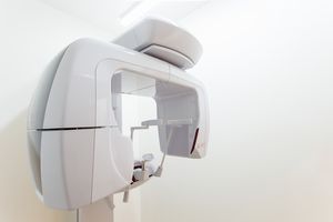 CT撮影による正確な診断